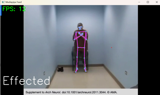 Cerebral Disease Detection Image